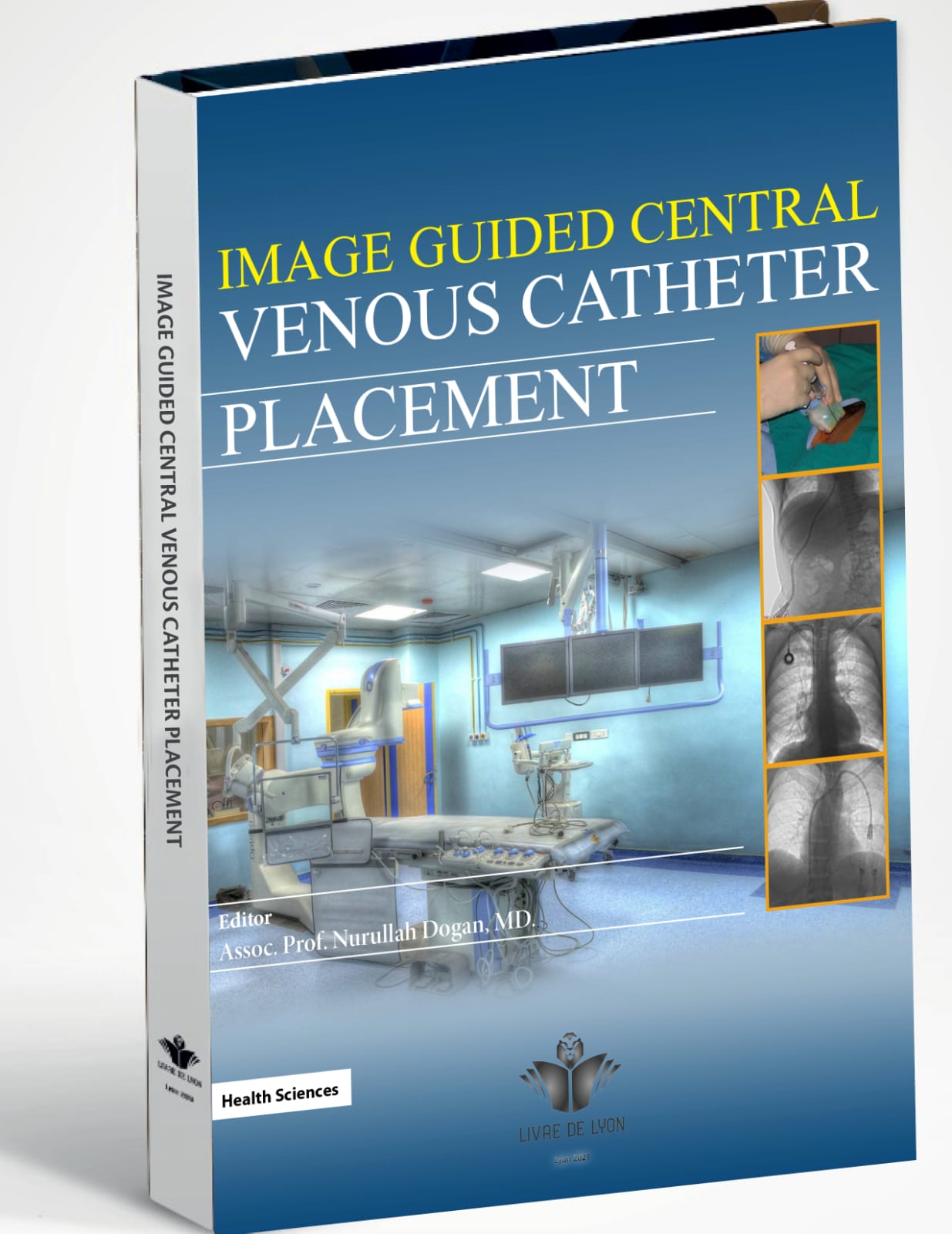 Image Guided Central Venous Catheter Placement